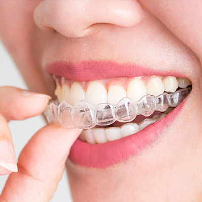 Orthodontics in Tallahassee