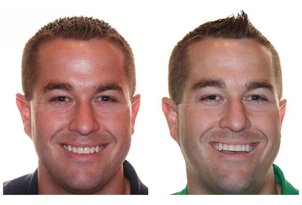 GoodSmiles Dental Care