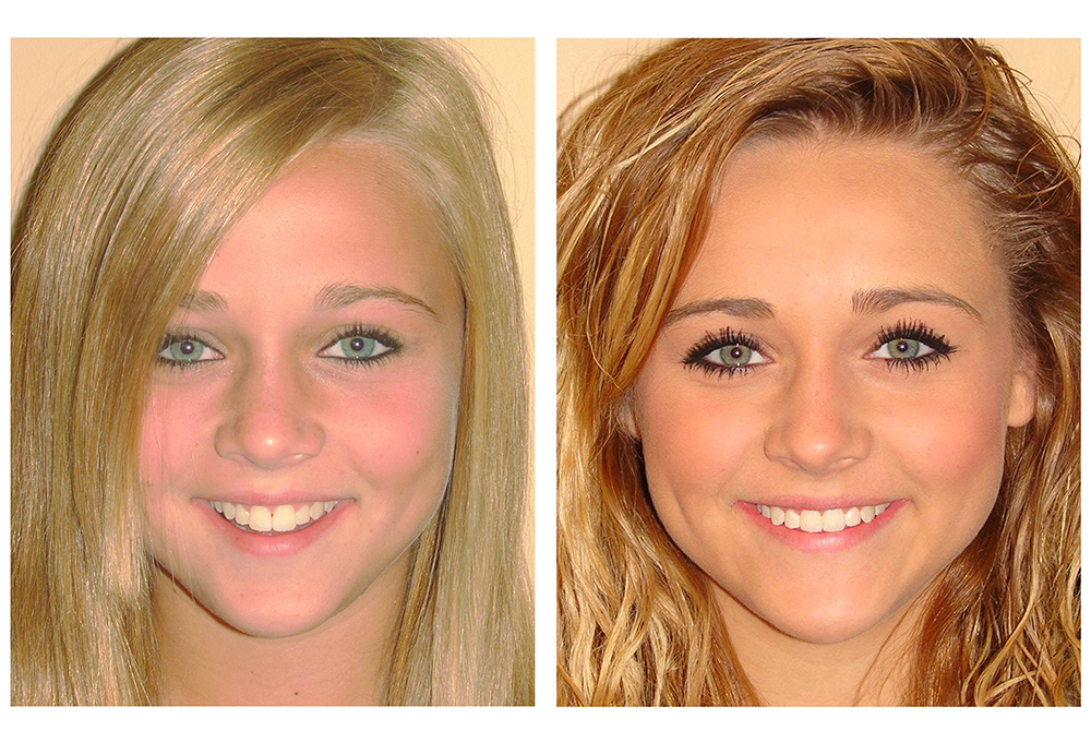 GoodSmiles Dental Care