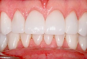 GoodSmiles Dental Care | Teeth Whitening, Root Canals and Dental Cleanings