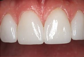 GoodSmiles Dental Care | CEREC reg , DermaFuse reg  and Implant Dentistry