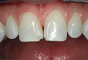 GoodSmiles Dental Care | Viora V30, Dental Bridges and CEREC reg 